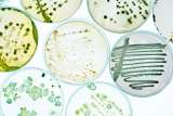 Fighting bacterial infections FASTer – Health News