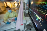 What is RSV and why is it surging across the U.S.?