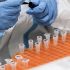 Sudan detects 5 more cases of monkeypox amid concerns
