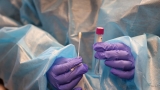 What to Do if You Are Exposed or Test Positive – NBC Chicago