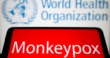 ‘Urgency’: WHO expects more monkeypox cases globally | World Health Organization News