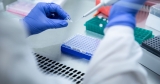 COVID case counts to increase as CDC addresses backlog 