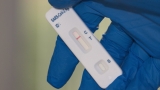 Are COVID Symptoms Changing With New Variants? Chicago’s Top Doc Explains – NBC Chicago