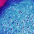 COVID vaccine for kids under 5 welcomed by South NJ parents