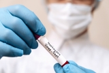 CDC: Texas monkeypox case count climbs to 20