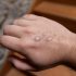 N.J reports 1,408 COVID cases, 1 death, as more than half the state’s nursing homes report outbreaks