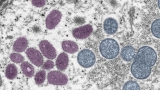 CDC sees new spike in cases as virus spreads