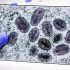 IBD treatments may boost COVID-19 vaccine response