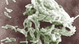 Why throwing out food isn’t enough to stop the spread of listeria