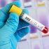 A universal vaccine to end COVID pandemics? It’s in the Army’s sights
