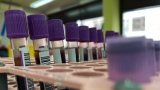 CDC report shows how infectious mpox is and how important vaccination was in stemming outbreak – Deltaplex News