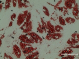 Molecule Boosts Fat Burning | Worldhealth.net Anti-Aging News