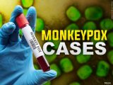 CDC plans for increase mokeypox cases following confirmed cases in Alabama