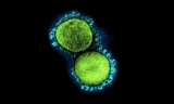 Assessing the association of COVID-19 and Immunoglobulin A vasculitis in children