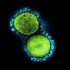 CDC Backs Full Approval of Moderna COVID-19 Vaccine – Consumer Health News