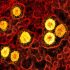 Applied UV’s Airocide® and Lumicide Address CDC’s Recommendation for Handling Environments Contaminated by Monkeypox