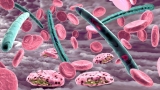 How frequent was SARS-CoV-2 and malaria co-infection during the first wave of the pandemic?