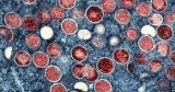 Ohio working to distribute limited monkeypox vaccines; risk low for most