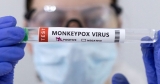 U.S. monkeypox cases may be peaking, experts say