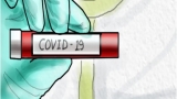 After Omicron infection of Covid 19 will come again but this time there will be no epidemic big disclosure in study mhpv
