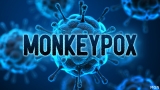 Riverside County reports 4 more monkeypox cases, total now 252