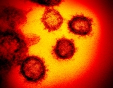 COVID has infected 94% of US residents and immunity is higher than a year ago