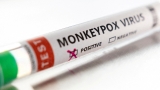 Monkeypox outbreak: CDC activates Emergency Operations Center to bolster agency’s response