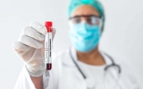 Monkeypox reported in four states