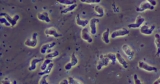 Swimmer Dies After Contracting ‘Brain-Eating Amoeba’ in Lake in Iowa
