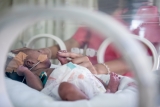 Neonatal sepsis: Alarming number of newborns losing their lives