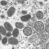 COVID-19 cases are rising sharply again — should we worry?