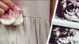 Pregnant women with COVID-19 are at increased risk for preterm birth, CDC says
