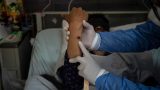Indonesia confirms first monkeypox case: Health ministry | World News