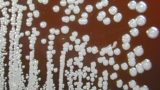 Bacterium that causes rare disease likely endemic along Gulf Coast