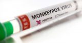Poland reports first case of monkey pox – PAP news agency