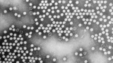 N.Y. state detects polio case, first in the U.S. since 2013