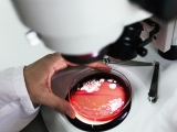 Probiotics could complement antidepressant treatment