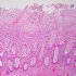 Coronavirus Morning News Brief – Aug. 18: CDC Reshuffles, Study Finds Link Between Covid and Dementia