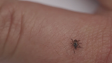 Lyme disease cases in Virginia are higher than reported