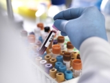 NHS launches world first trial for blood test that detects cancer
