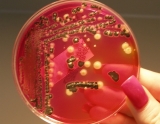 CDC posts food safety alert about multistate outbreak of Salmonella Senftenberg infections