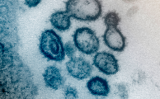 Florida residents kept out of loop on pandemic toll