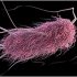 Washington state’s King County declares monkeypox a public health emergency
