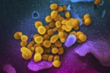 1 in 5 adults have health condition that might be linked to COVID illness