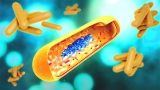 COVID-19 disruptions may have delayed tuberculosis diagnoses