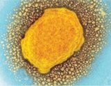 Vaccine and testing delays for monkeypox echo failures in early covid response