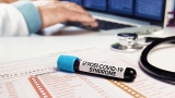 Long-Covid will be the lingering legacy of further waves of virus