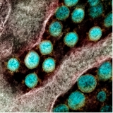 Scientists Use Machine Learning Models to Help Identify Long COVID Patients