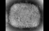 Israel rules out monkeypox in 2nd patient suspected of having rare disease