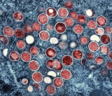 CDC releases interim guidance for prevention, treatment of monkeypox